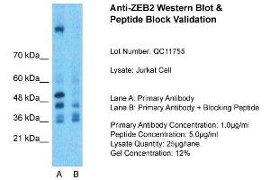 Host:  Rabbit  Target Name:  ZEB2  Sample Type:  Jurkat Whole Cell  Lane A:  Primary Antibody  Lane B:  Primary Antibody + Blocking Peptide  Primary Antibody Concentration:  1ug/ml  Peptide Concentration:  5ug/ml  Lysate Quantity:  25ug/lane/Lane  Gel Concentration:  0. (ZEB2 antibody  (N-Term))