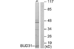 Western blot analysis of extracts from Jurkat cells, using BUD31 antibody. (BUD31 antibody  (Internal Region))