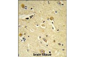 Formalin-fixed and paraffin-embedded human brain tissue reacted with CDIPT Antibody (Center), which was peroxidase-conjugated to the secondary antibody, followed by DAB staining. (CDIPT antibody  (AA 99-125))