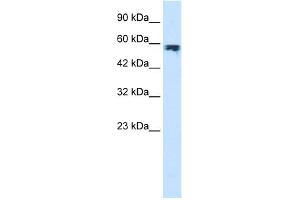 WB Suggested Anti-ZYX Antibody Titration:  1. (ZYX antibody  (Middle Region))