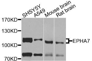Western blot analysis of extracts of various cells, using EPHA7 antibody. (EPH Receptor A7 antibody)