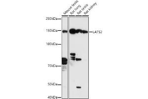 Western blot analysis of extracts of various cell lines, using L antibody (ABIN7268192) at 1:500 dilution. (LATS2 antibody  (AA 1-100))