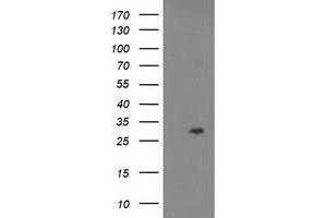 Western Blotting (WB) image for anti-Cyclin-Dependent Kinase Inhibitor 3 (CDKN3) antibody (ABIN1497461) (CDKN3 antibody)