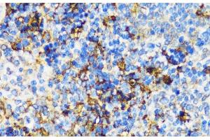 Immunohistochemistry of paraffin-embedded Mouse spleen using PBEF / NAMPT Polyclonal Antibody at dilution of 1:100 (40x lens). (NAMPT antibody)