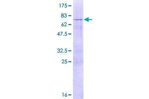 TBC1D20 Protein (AA 1-403) (GST tag)