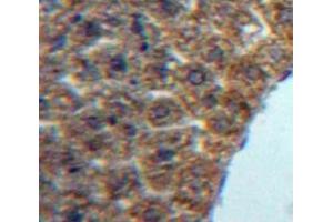 #VALUE! (LECT1 antibody  (AA 134-334))