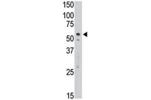 SIGLEC7 antibody used in western blot to detect Dsiglec/SIGLEC7 in Jurkat cell lysate (SIGLEC7 antibody  (AA 407-438))