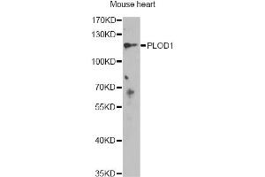 Western blot analysis of extracts of mouse heart, using PLOD1 antibody.