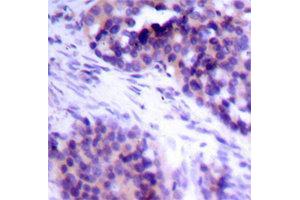 Immunohistochemistry (IHC) image for anti-BCL2-Like 1 (BCL2L1) (pSer62) antibody (ABIN3020106) (BCL2L1 antibody  (pSer62))