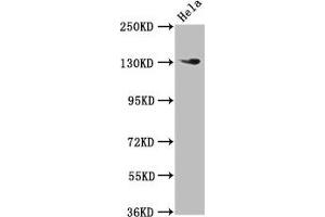 Western Blot Positive WB detected in: Hela whole cell lysate All lanes: NOMO1 antibody at 3 μg/mL Secondary Goat polyclonal to rabbit IgG at 1/50000 dilution Predicted band size: 135 kDa Observed band size: 135 kDa (NOMO1 antibody  (AA 918-1044))