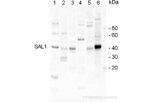 Western Blotting (WB) image for anti-Inositol Polyphosphate-1-Phosphatase (INPP1) antibody (ABIN334556) (INPP1 antibody)