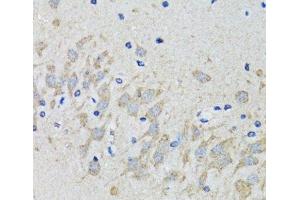 Immunohistochemistry of paraffin-embedded Mouse brain using HTR2B Polyclonal Antibody at dilution of 1:100 (40x lens). (Serotonin Receptor 2B antibody)