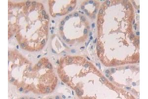 Detection of CTSS in Human Kidney Tissue using Polyclonal Antibody to Cathepsin S (CTSS) (Cathepsin S antibody  (AA 115-331))