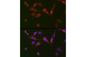 Immunofluorescence analysis of BALB-3T3 cells using GDF15 Rabbit pAb (ABIN3020658, ABIN3020659, ABIN3020660, ABIN1512942 and ABIN6213652) at dilution of 1:100 (40x lens). (GDF15 antibody  (AA 49-308))