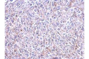 IHC-P Image Immunohistochemical analysis of paraffin-embedded HeLa xenograft, using Histamine H3 Receptor, antibody at 1:500 dilution. (HRH3 antibody  (C-Term))