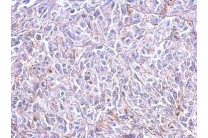 IHC-P Image Immunohistochemical analysis of paraffin-embedded HeLa xenograft, using Histamine H3 Receptor, antibody at 1:500 dilution. (HRH3 antibody  (C-Term))