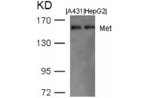 Image no. 1 for anti-Met Proto-Oncogene (MET) (AA 1001-1005) antibody (ABIN401652)