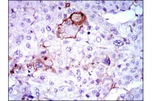 Immunohistochemistry (IHC) image for anti-Lipoprotein (Lp(a)) (AA 4330-4521) antibody (ABIN1845714) (Lp(a) antibody  (AA 4330-4521))