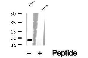 Western blot analysis of extracts of HeLa cells, using SRP14 antibody.