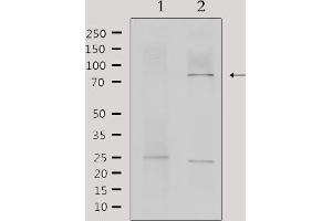 Western blot analysis of extracts from mouse brain, using MTA1 Antibody. (MTA1 antibody  (Internal Region))
