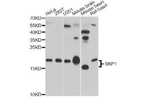 Western blot analysis of extracts of various cell lines, using SKP1 antibody. (SKP1 antibody)