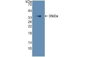 Detection of Recombinant GDI1, Human using Polyclonal Antibody to GDP Dissociation Inhibitor 1 (GDI1) (GDI1 antibody  (AA 1-274))