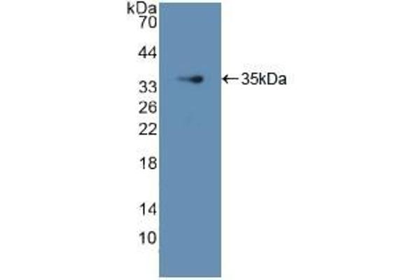 GDI1 anticorps  (AA 1-274)