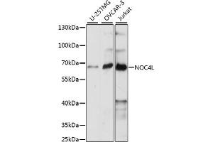 Western blot analysis of extracts of various cell lines, using NOC4L antibody (ABIN7269029) at 1:1000 dilution. (NOC4L antibody  (AA 1-260))