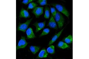 IF analysis of ALPP using anti-ALPP antibody (ABIN7602772). (PLAP antibody  (C-Term))