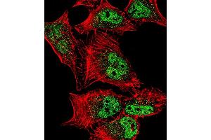 Fluorescent confocal image of Hela cell stained with MEF2C Antibody  (ABIN390244 and ABIN2840710).