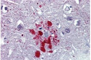 Human Brain, Cortex, Senile Plaque (formalin-fixed, paraffin-embedded) stained with Ubiquitin antibody ABIN462018 at 10 ug/ml followed by biotinylated anti-mouse IgG secondary antibody ABIN481714, alkaline phosphatase-streptavidin and chromogen. (Ubiquitin antibody)