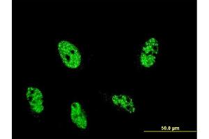 Immunofluorescence of monoclonal antibody to ARID4A on HeLa cell. (ARID4A antibody  (AA 1033-1139))