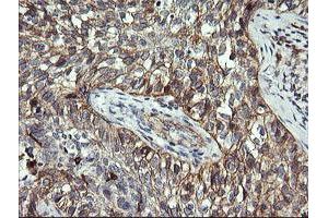 Immunohistochemistry (IHC) image for anti-T-cell surface glycoprotein CD1c (CD1C) antibody (ABIN2670676) (CD1c antibody)
