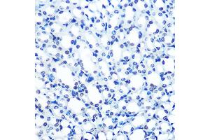 Immunohistochemistry of paraffin-embedded mouse kidney using  Rabbit mAb (ABIN7265458) at dilution of 1:100 (40x lens). (ADAR antibody)