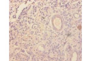 Immunohistochemistry of paraffin-embedded human kidney tissue using ABIN7177029 at dilution of 1:100 (CCL4 antibody  (AA 24-92))