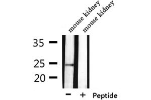 Western blot analysis of extracts from mouse kidney, using CD53 Antibody. (CD53 antibody  (Internal Region))