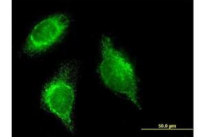Immunofluorescence of monoclonal antibody to SFTPD on HeLa cell. (SFTPD antibody  (AA 21-375))