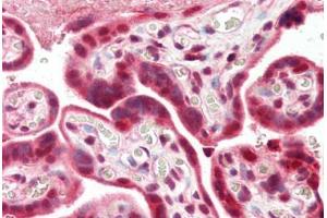 Immunohistochemistry (Paraffin-embedded Sections) (IHC (p)) image for anti-Poly (ADP-Ribose) Polymerase 1 (PARP1) (AA 396-412) antibody (ABIN462086)