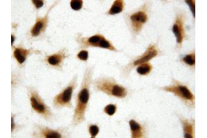 Anti-Apoptosis inhibitor 5 antibody, ICC ICC: HELA Cell (Apoptosis Inhibitor 5 antibody  (C-Term))