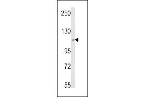 Western blot analysis of SKIV2L2 Antibody (Center) (ABIN652687 and ABIN2842458) in MCF-7 cell line lysates (35 μg/lane). (MTR4 antibody  (AA 237-263))