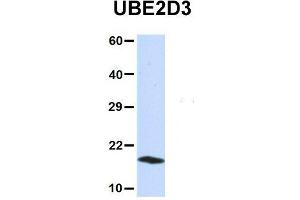 Western Blotting (WB) image for anti-Ubiquitin-Conjugating Enzyme E2D 3 (UBE2D3) (N-Term) antibody (ABIN2775674)