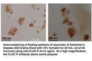 At 5- 10ug/ml, positive staining of senile plaques in AD brains. (COL25A1 antibody  (AA 430-445))