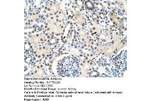Human kidney (AKAP8L antibody  (C-Term))
