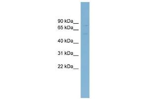 ABCG5 antibody used at 1 ug/ml to detect target protein. (ABCG5 antibody)