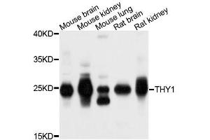 Western blot analysis of extracts of various cell lines, using THY1 antibody.