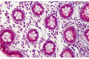 Anti-PPAR Delta antibody IHC of human colon. (PPARD antibody  (AA 39-54))
