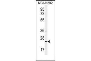 Western blot analysis of GSTA3 Antibody (N-term) in NCI-H292 cell line lysates (35ug/lane).