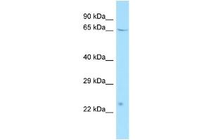 WB Suggested Anti-ATF7IP2 Antibody Titration: 1.