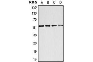Western blot analysis of ATF2 expression in HeLa (A), MCF7 (B), NIH3T3 (C), PC12 (D) whole cell lysates.