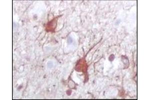 Immunohistochemistry (IHC) image for anti-S100 Calcium Binding Protein B (S100B) (full length) antibody (ABIN2464102) (S100B antibody  (full length))